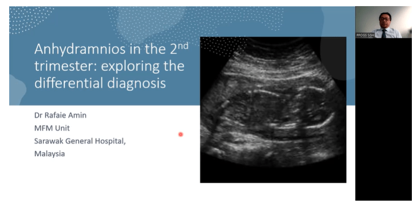 Anhydramnios in the 2nd trimester: Exploring the differential&nbsp;diagnosis